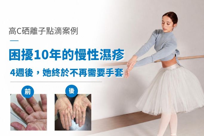 【困擾10年的慢性濕疹，4週後，她終於不再需要手套】L女士 | 高C硒離子點滴案例